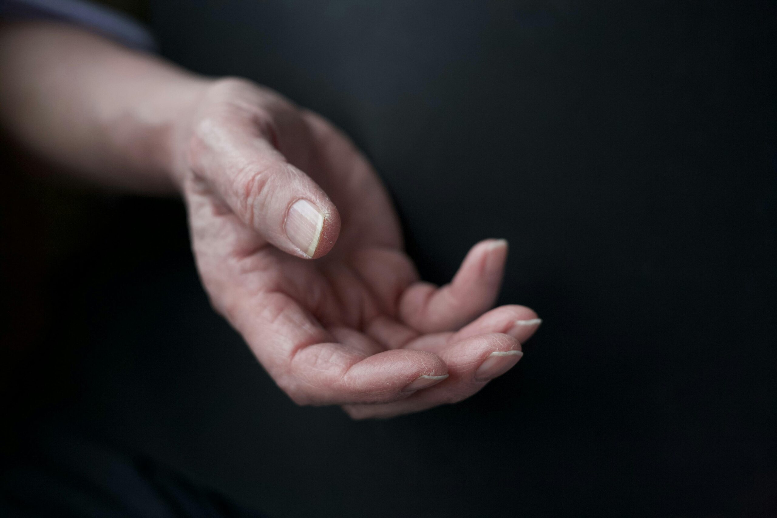 Nahaufnahme einer älteren Hand auf dunklem Hintergrund, die Wärme und Struktur vermittelt.